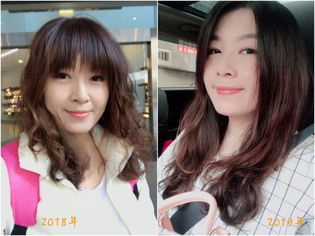 【醫美】法令紋打玻尿酸心得分享(佳思優整形醫美診所)