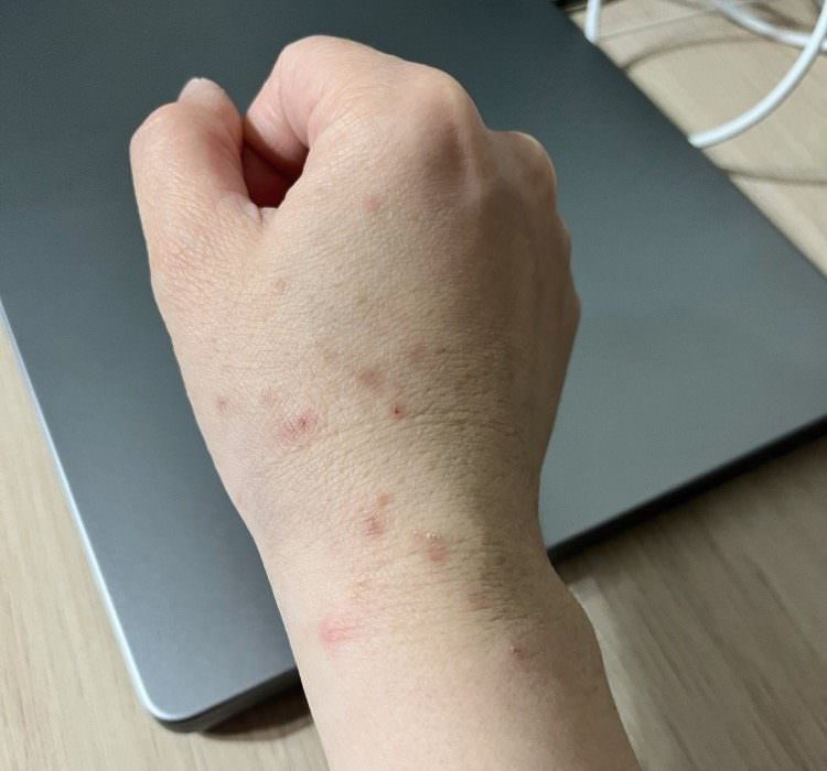 薏仁錠推薦｜精選 3 品牌薏仁錠、薏仁飲與 BWYA 草本薏仁錠升級版Plus+實際心得！