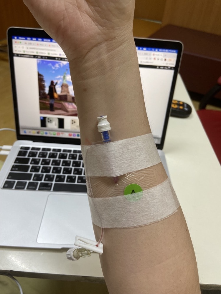 【第三次腹腔鏡手術】巧克力囊腫/子宮肌腺症檢查、住院、開刀手術實際紀錄 - 第24張圖 【第三次腹腔鏡手術】巧克力囊腫/子宮肌腺症檢查、住院、開刀手術實際紀錄