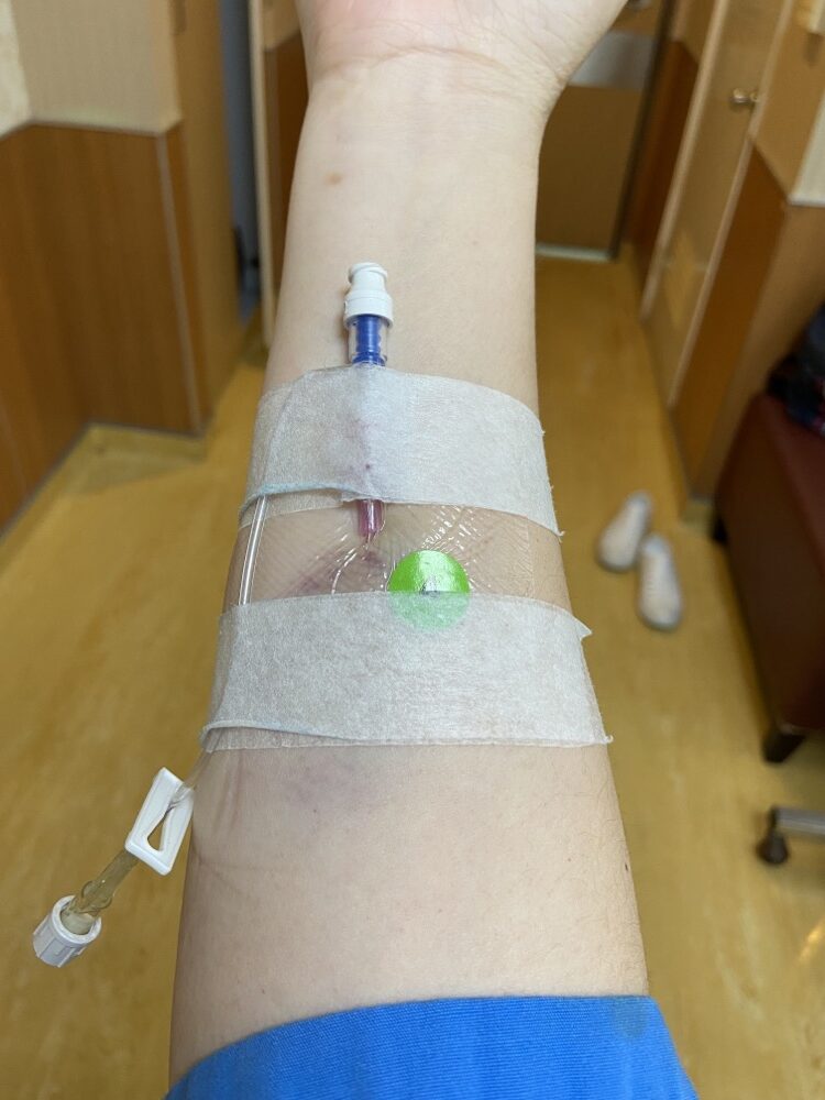 【第三次腹腔鏡手術】巧克力囊腫/子宮肌腺症檢查、住院、開刀手術實際紀錄 - 第27張圖 【第三次腹腔鏡手術】巧克力囊腫/子宮肌腺症檢查、住院、開刀手術實際紀錄