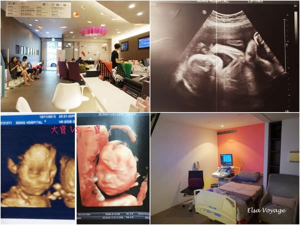 【二寶懷孕日記】21w禾馨高層次超音波與第六個月產檢記錄